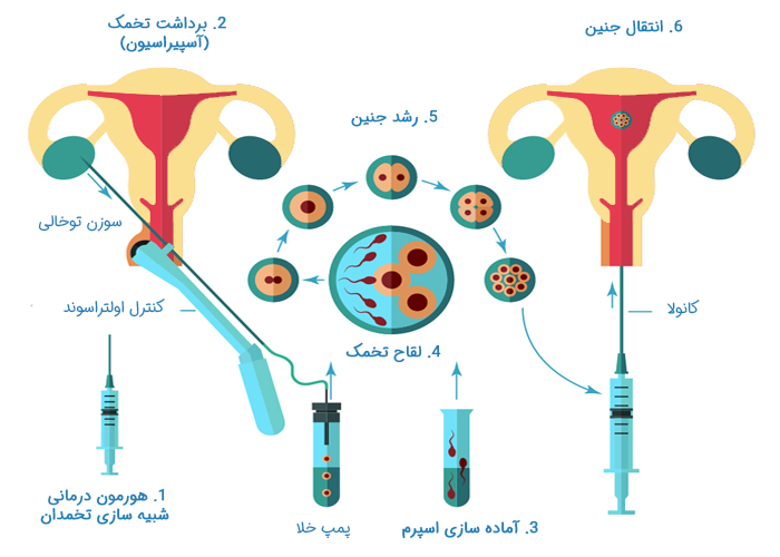 نحوه چگونگی لقاح خارج رحمی