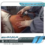 تصاویری-از-اندومتریوز