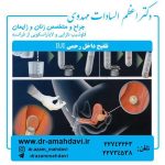 تلقیح داخل رحمی