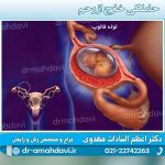 حاملگی-خارج-از-رحم