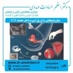 میکرواینجکشن