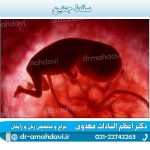 سقط-جنین