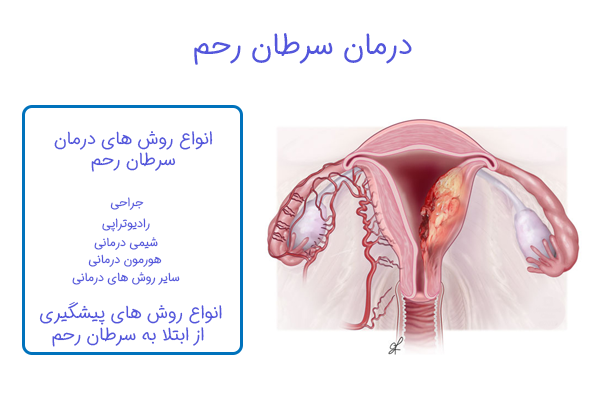 درمان سرطان دهانه رحم