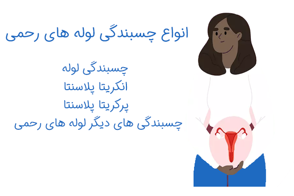 انواع چسبندگی های رحمی