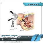 هزینه کولپوسکوپی