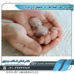 عکس-سقط-مکرر