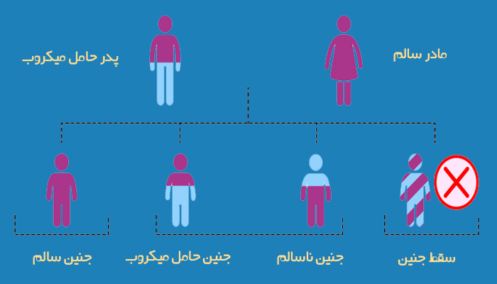 علت ژنتیکی سقط مکرر