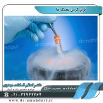 فریز-کردن-تخمک