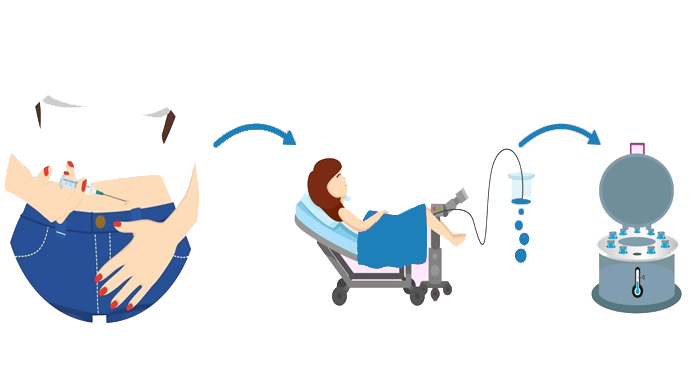 مراحل تخمک گذاری