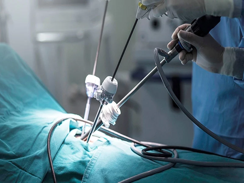 شناخت بهترین جراح لاپاراسکوپی