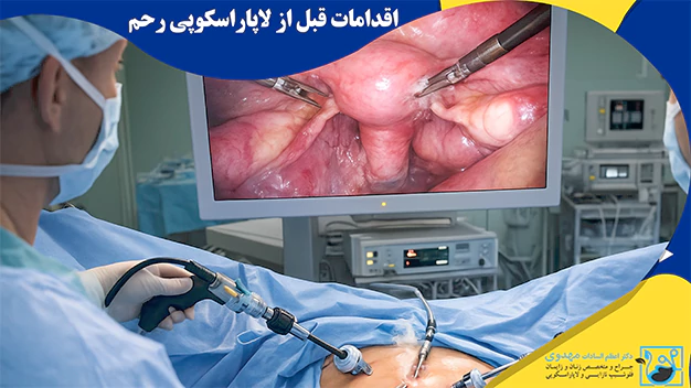 اقدامات قبل از لاپاراسکوپی رحم اقدامات قبل از لاپاراسکوپی رحم