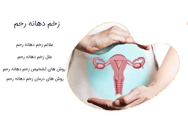 زخم دهانه رحم