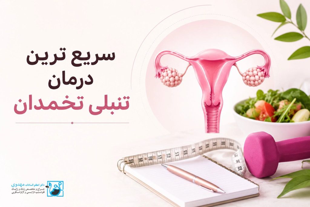 تنبلی تخمدان (PCOS) چیست و چرا باید سریع درمان شود؟
