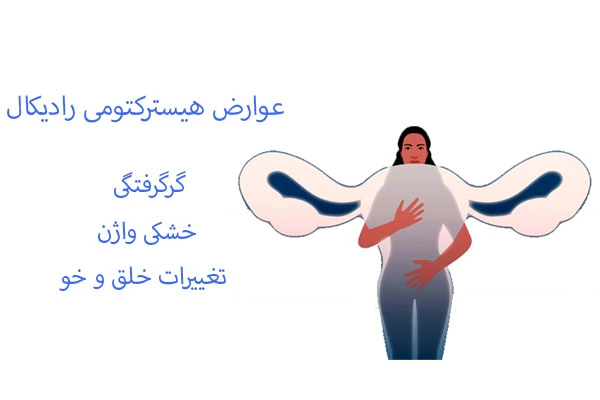 عوارض هیسترکتومی رادیکال