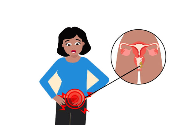 عواارض هیستروسکوپی