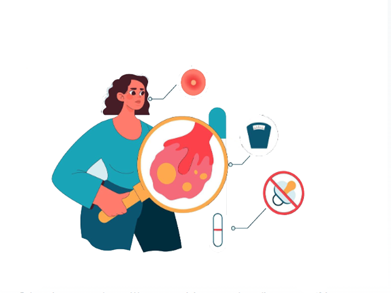 کیست فولیکولی تخمدان ها