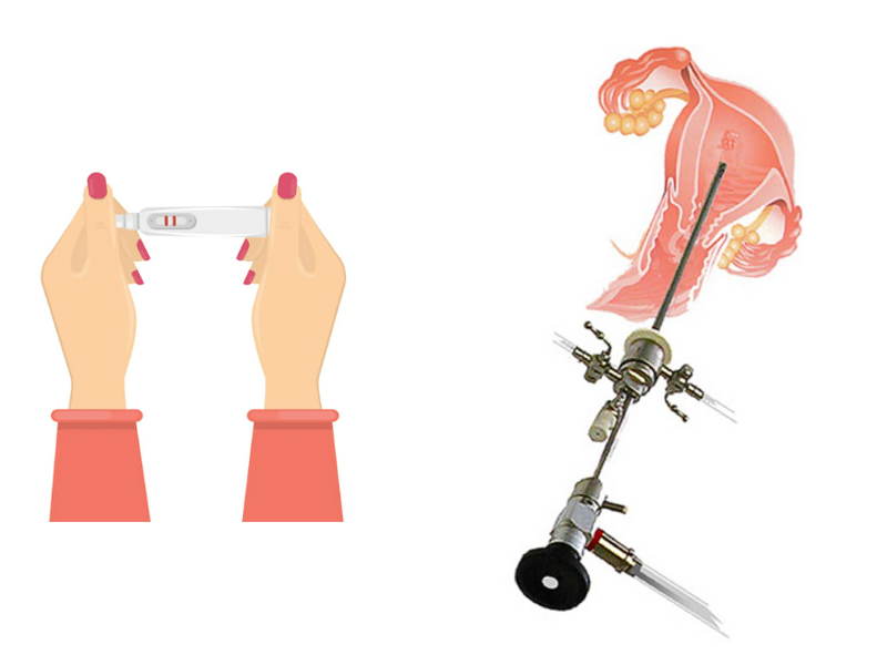 هیستروسکوپی و بارداری