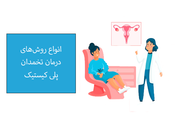 انواع روش‌های درمان سندرم تخمدان پلی کیستیک