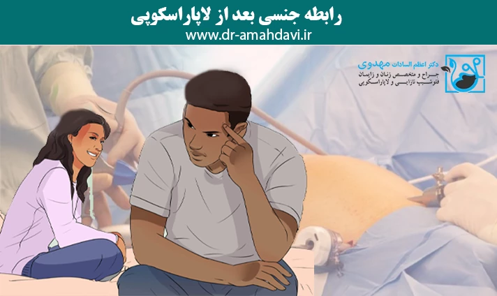 رابطه جنسی بعد از لاپاراسکوپی