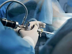 تفاوت لاپاراسکوپی و هیستروسکوپی در عوارض