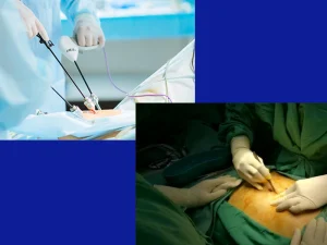 فرق لاپاراسکوپی و لاپاراتومی