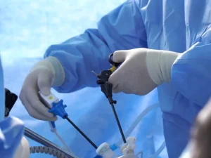 لاپاراسکوپی فیبروم