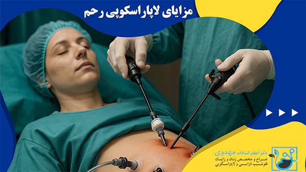 مزایای لاپاراسکوپی رحم