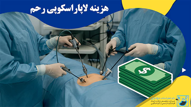 هزینه لاپاراسکوپی رحم