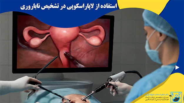 استفاده از لاپاراسکوپی در تشخیص ناباروری استفاده از لاپاراسکوپی در تشخیص ناباروری