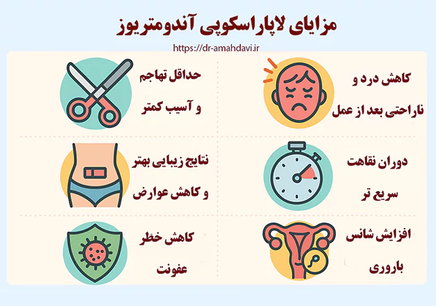 مزایای لاپاراسکوپی اندومتریوز مزایای لاپاراسکوپی اندومتریوز