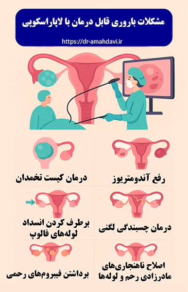مشکلات باروری قابل درمان با لاپاراسکوپی مشکلات باروری قابل درمان با لاپاراسکوپی