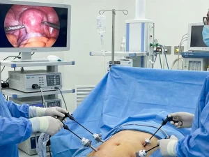 مهم ترین اقدامات قبل از لاپاراسکوپی